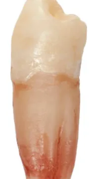Diagram of a full tooth including the crown and root, showing what a fully knocked-out tooth looks like