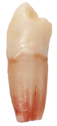 Diagram of a full tooth including the crown and root, showing what a fully knocked-out tooth looks like